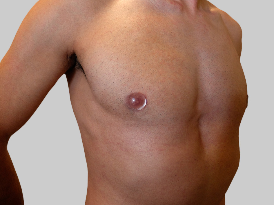 nipples-applied